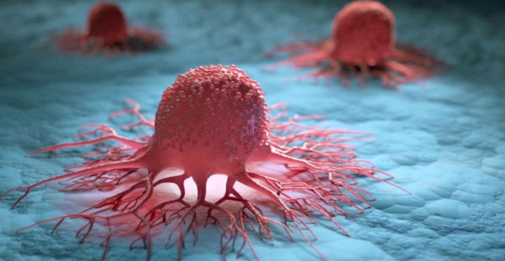 فنان شهير يكشف عن إصابته بالسرطان