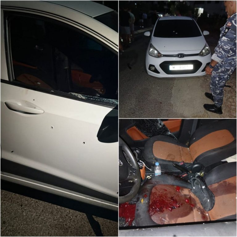 بالصورة بعد تعرضه لإطلاق نار في الدامور…إليكم هوية المستهدف