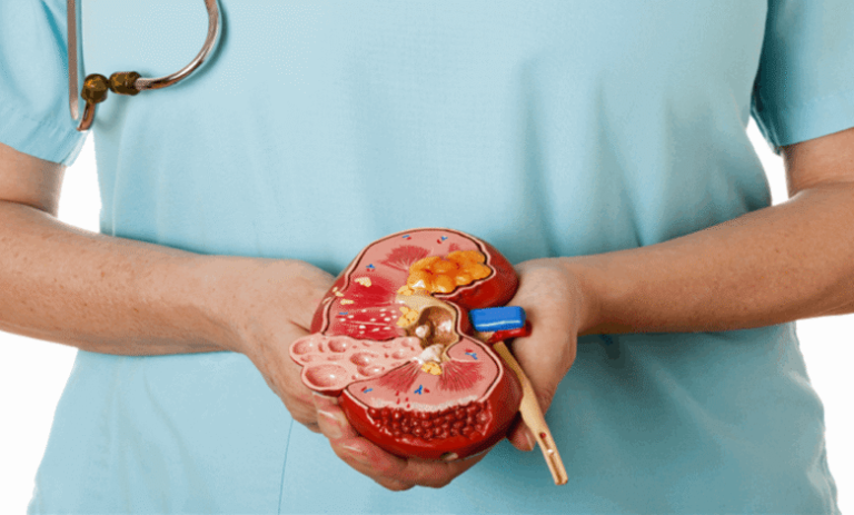 خبر مهمّ لمرضى الكلى