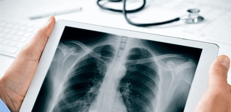 الأشعة السينية.. أداة تشخيص لا غنى عنها ومخاوف مبالغ فيها