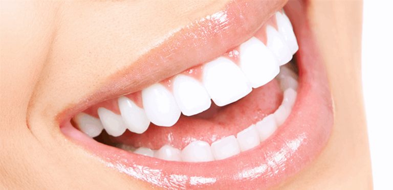 في عيادة لبنانية.. جَمّل أسنانه وهرب!