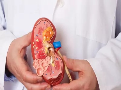 علامات تشير إلى تلف الكلى تظهر على الجلد